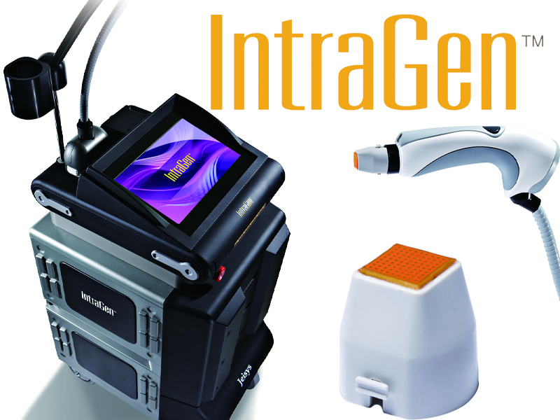 IntraGen電波 IntraGen電波