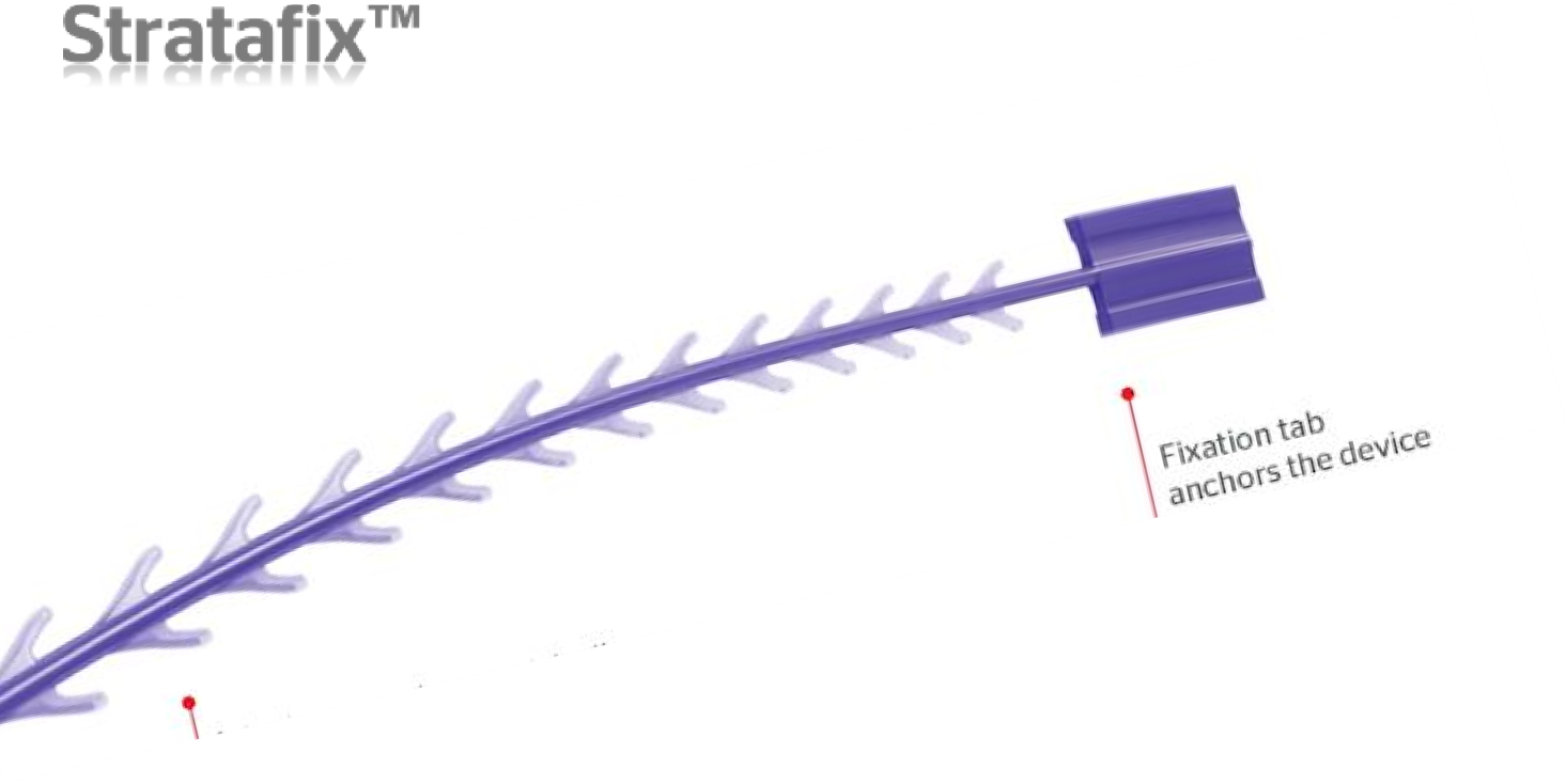 Stratafix藍鑽魚骨線